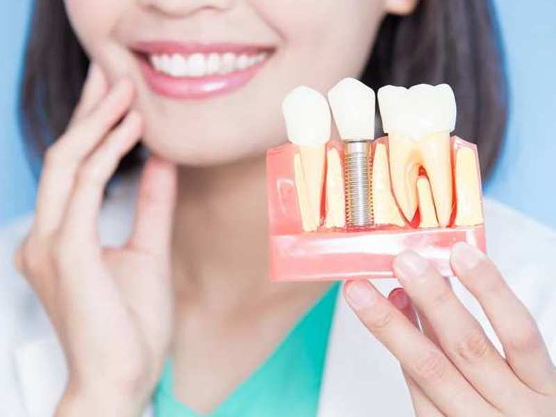 zubni implantati